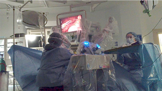 Dr. Tolozaによるロボット支援肺葉切除術